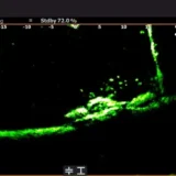 at2-xl-skiatook-crappie-na-skalnej-hromade-2--456-848m