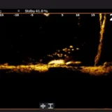 at2-xl-skiatook-crappie-na-skalnej-hromade-3--456-848n