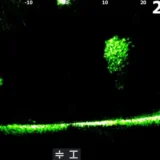 at2-xl-skiatook-zhluk-ryb--456-848i